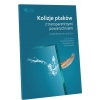 Kolizje ptaków z transparentnymi powierzchniami.